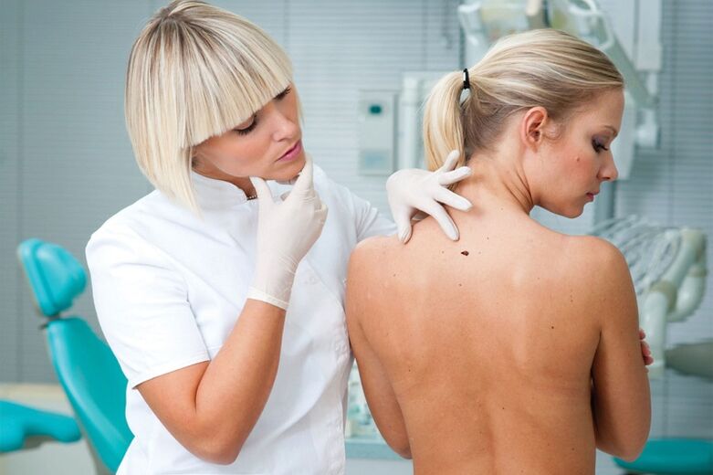 perché i papillomi compaiono sul corpo umano